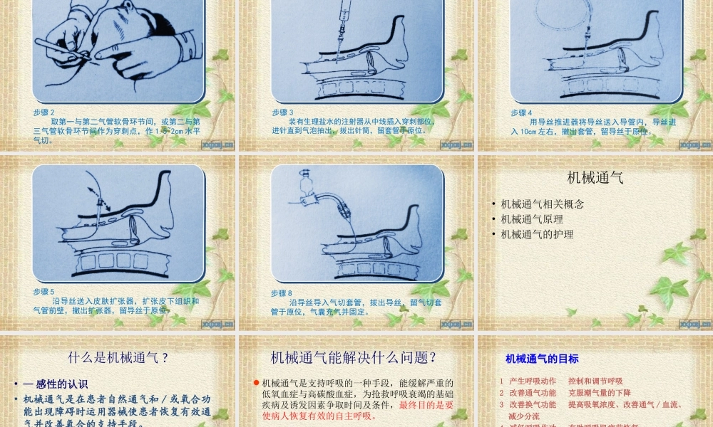 呼吸机检测及参数-(1).ppt