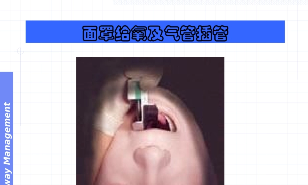 呼吸气囊和气管插管.pptx