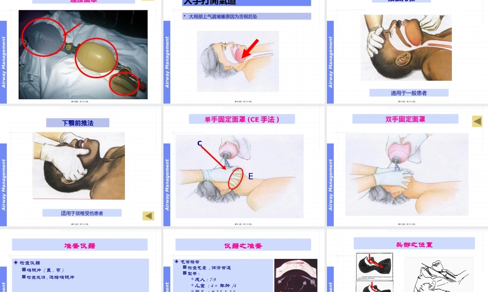 呼吸气囊和气管插管.pptx