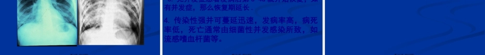 呼吸道感染细菌结核分枝杆菌白喉棒状杆菌嗜肺军团菌百日咳鲍特菌.pptx