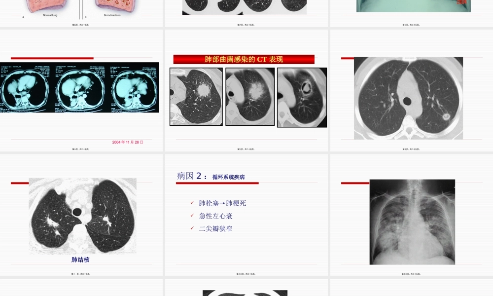 咯血-卢冰冰.pptx