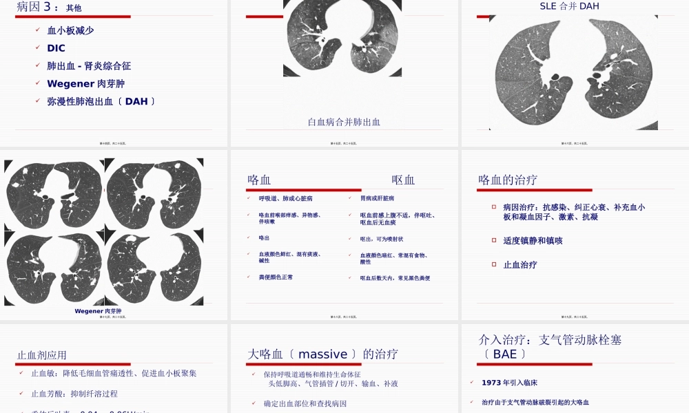 咯血-卢冰冰.pptx