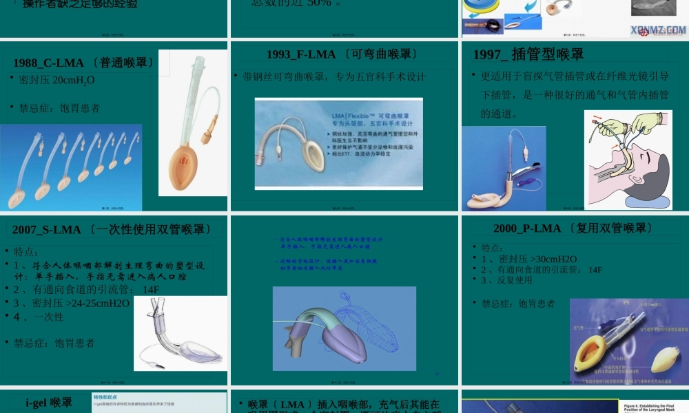 喉罩的使用资料.pptx