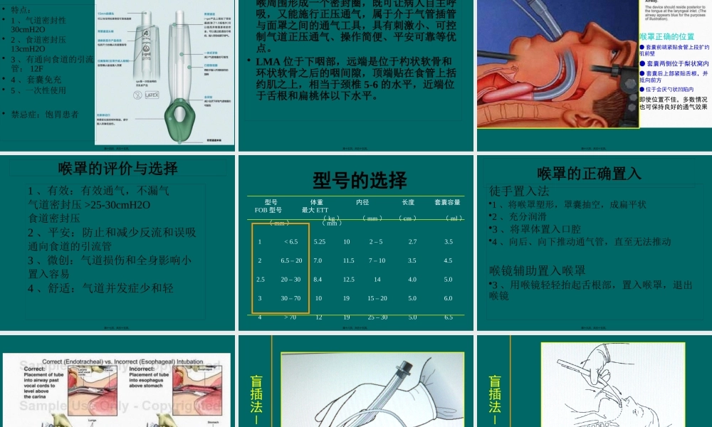 喉罩的使用资料.pptx