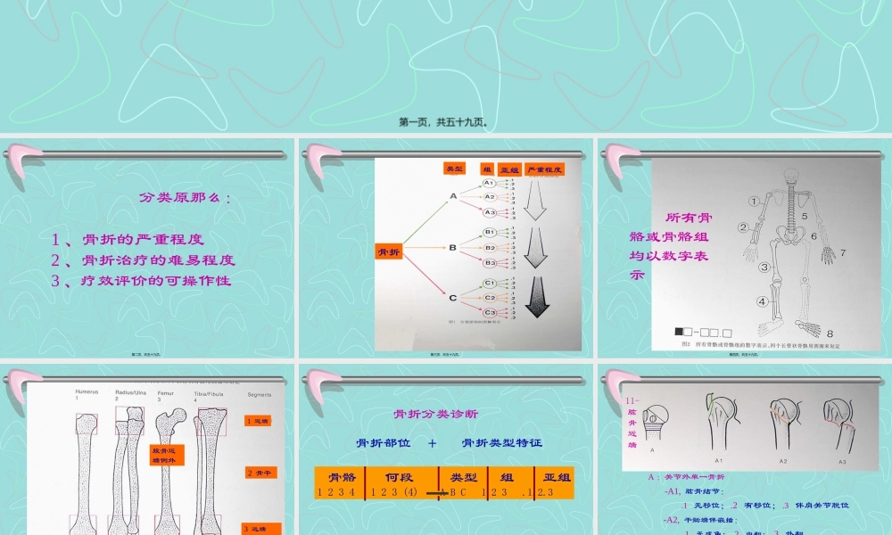 四肢长管状骨的-AO-综合分类.pptx