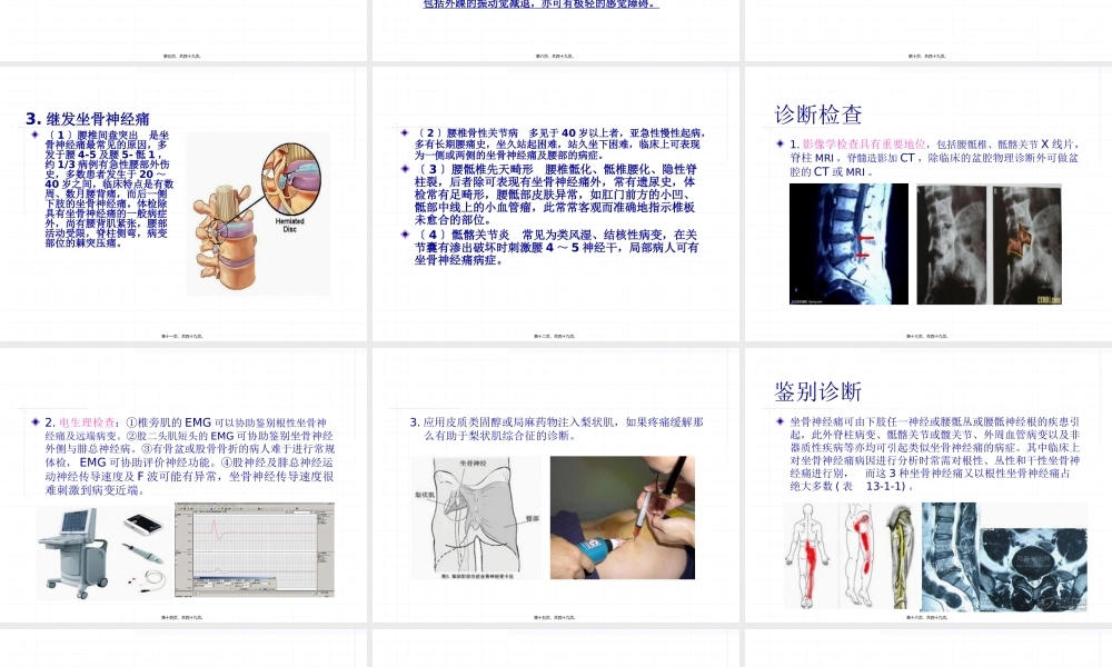 坐骨神经痛.pptx