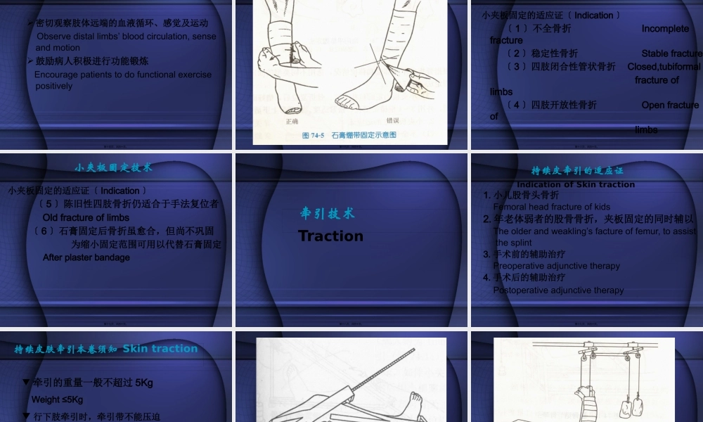 外科-骨科检查与操作.pptx