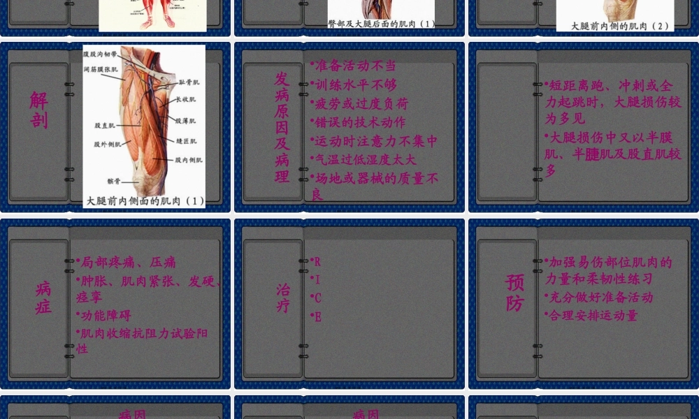 大腿损伤及功能康复.pptx