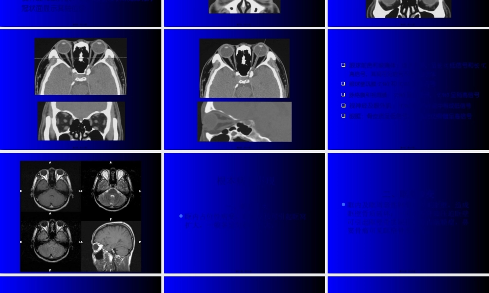 头颈部7年制影像.pptx