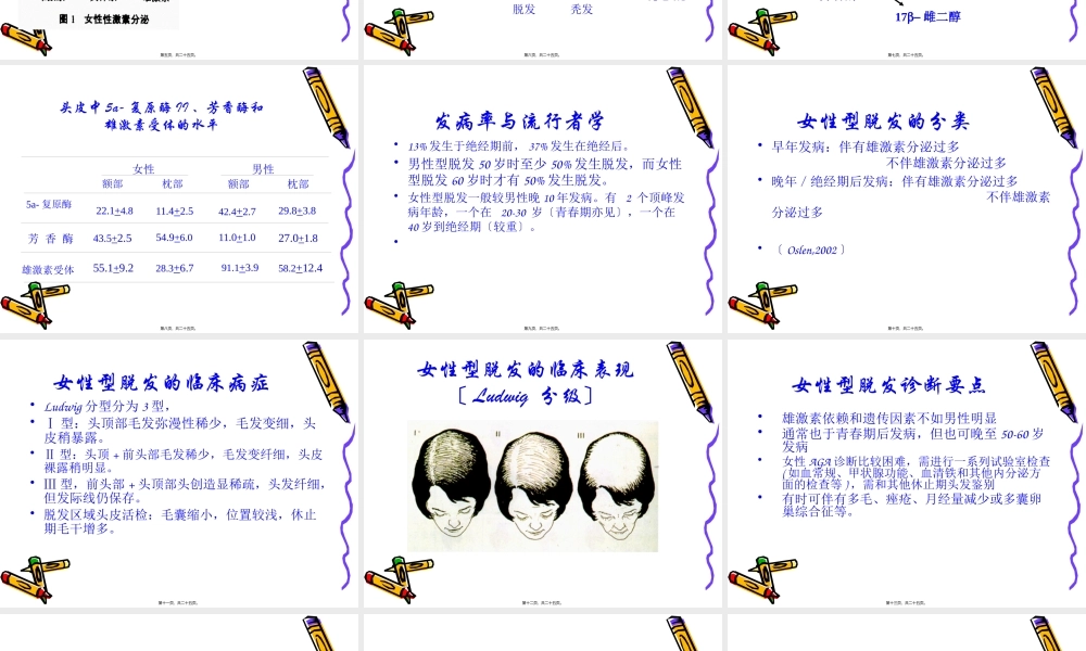 女性型脱发的特点及其诊疗进展.pptx