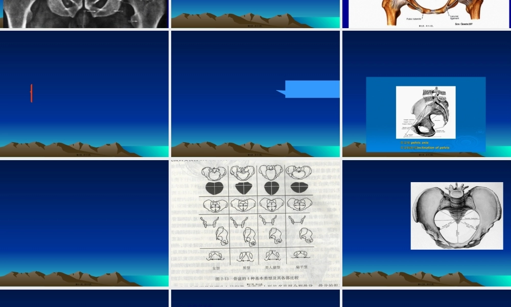 女性骨盆是产道的重要组成部分-.pptx