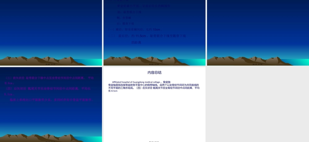 女性骨盆是产道的重要组成部分-.pptx