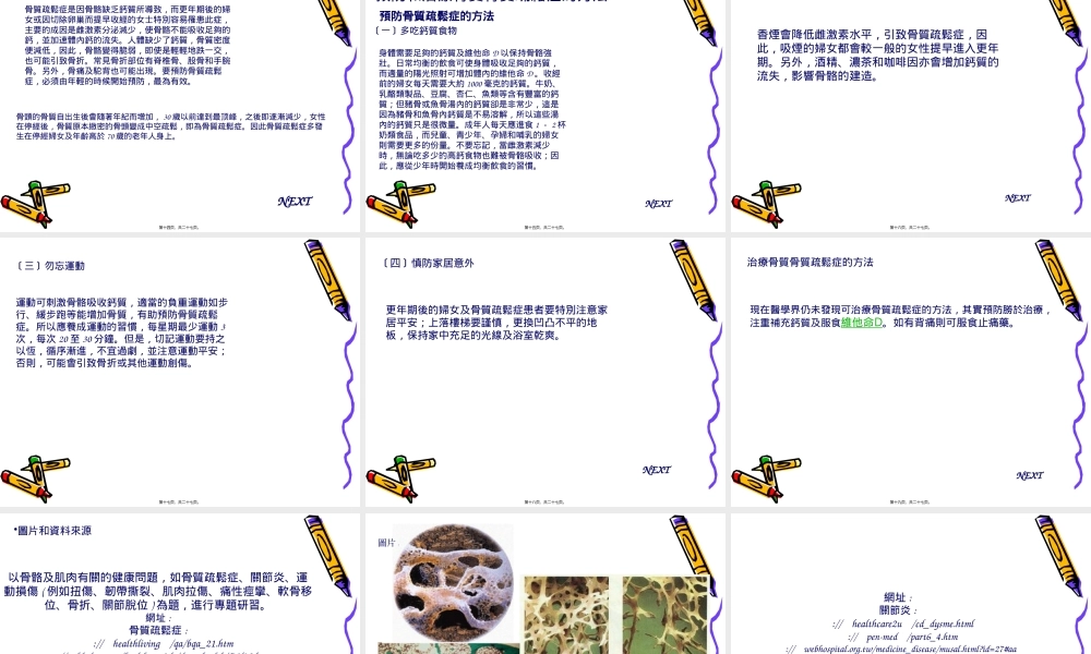 如骨质疏松症关节炎.pptx