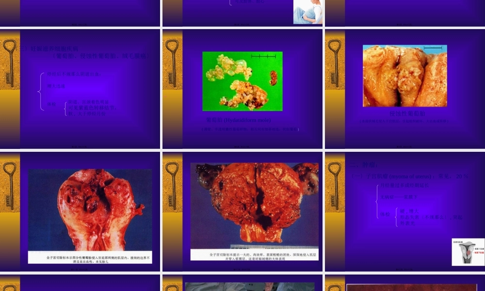 妇科-盆腔肿块.pptx