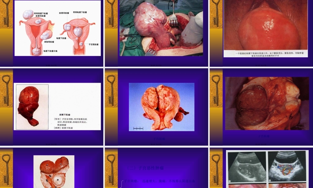 妇科-盆腔肿块.pptx