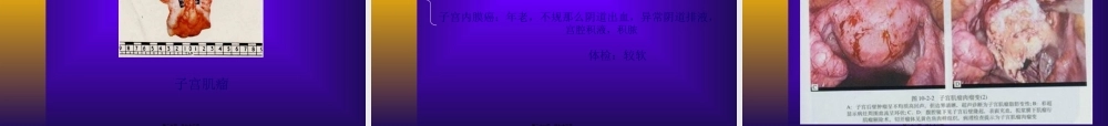 妇科-盆腔肿块.pptx