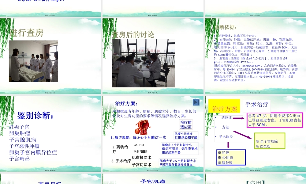 妇科子宫肌瘤教学查房新.pptx