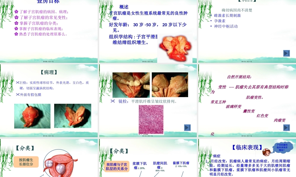 妇科子宫肌瘤教学查房新.pptx