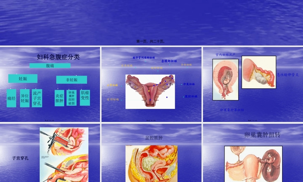 妇科急腹痛诊治思路.pptx
