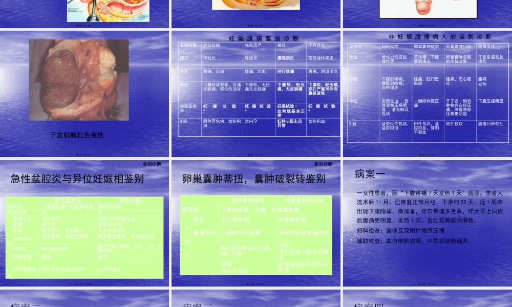 妇科急腹痛诊治思路.pptx