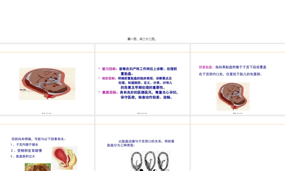 妊娠并发症之前置胎盘.pptx