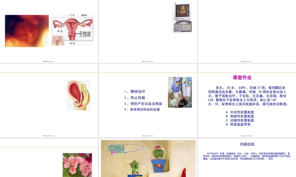 妊娠并发症之前置胎盘.pptx