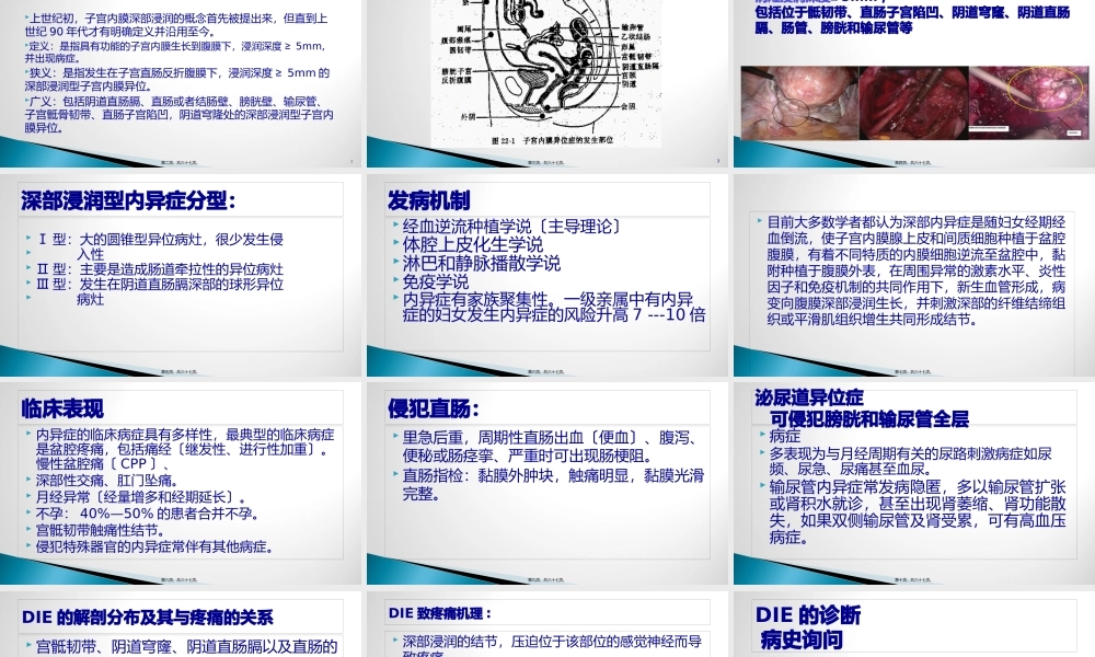 子宫内膜异位.pptx