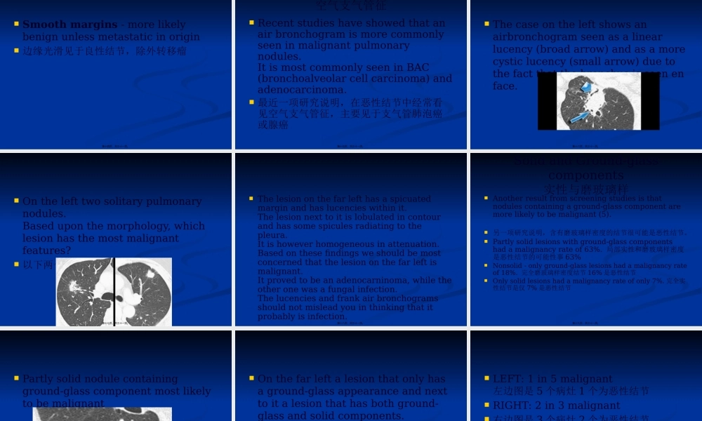 孤立性肺结节：良性与恶性对比..pptx