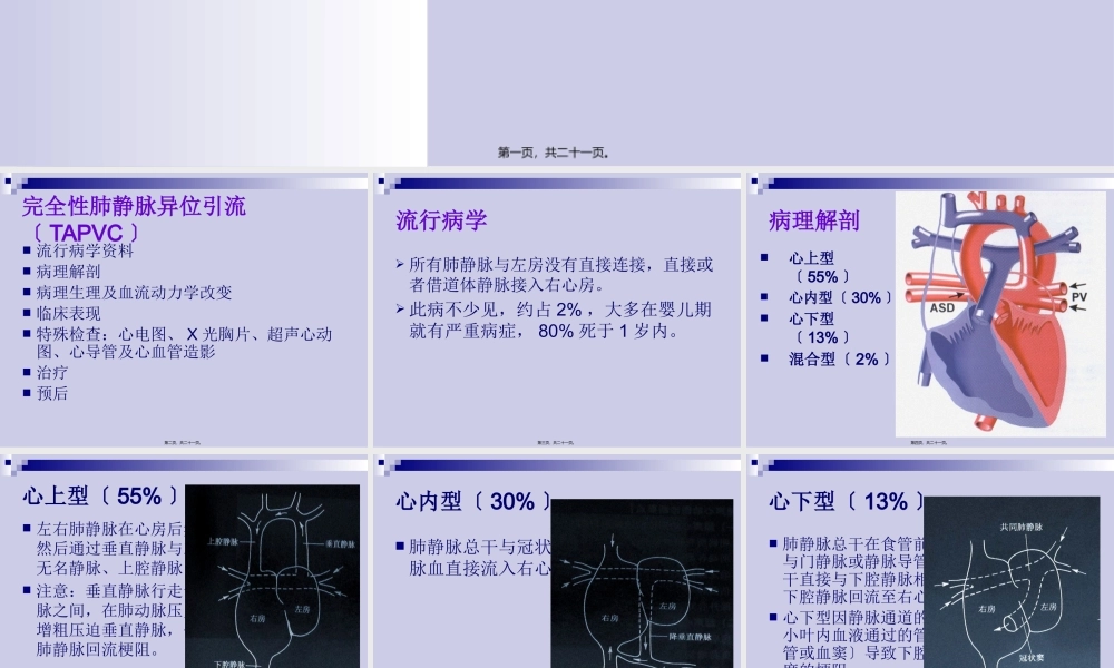 完全性肺静脉异位引流.pptx