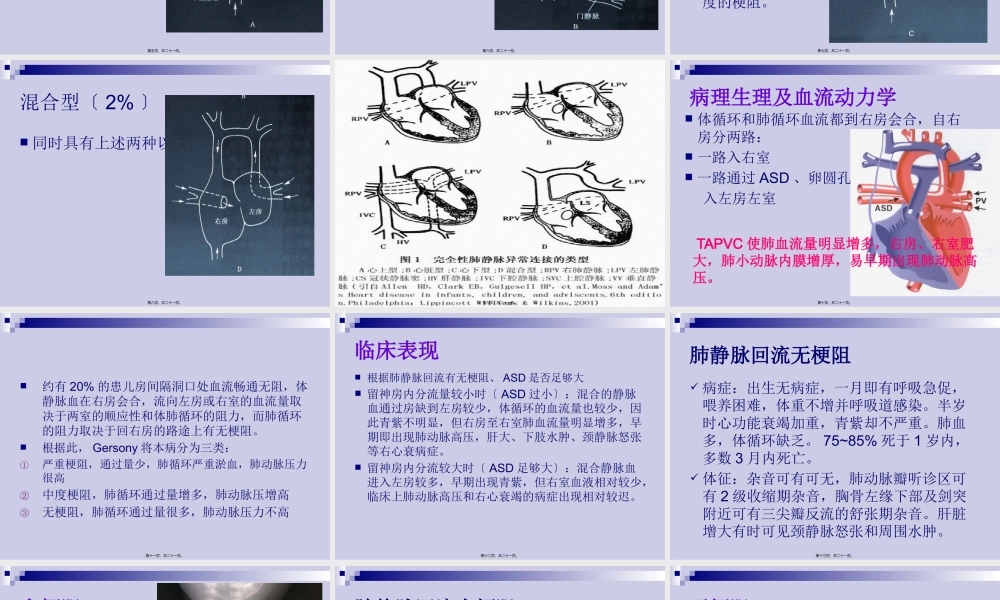 完全性肺静脉异位引流.pptx