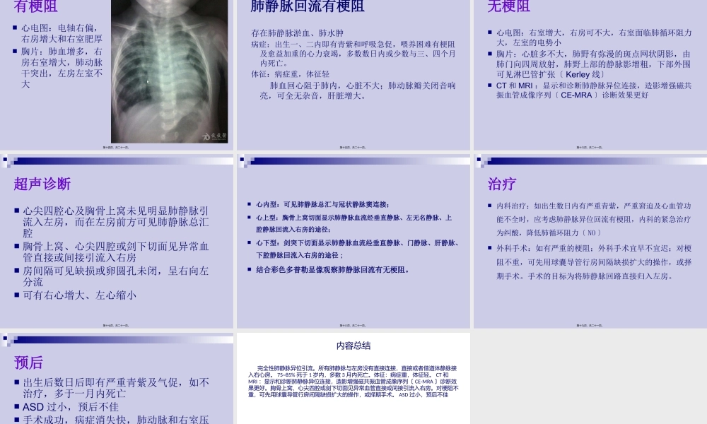 完全性肺静脉异位引流.pptx