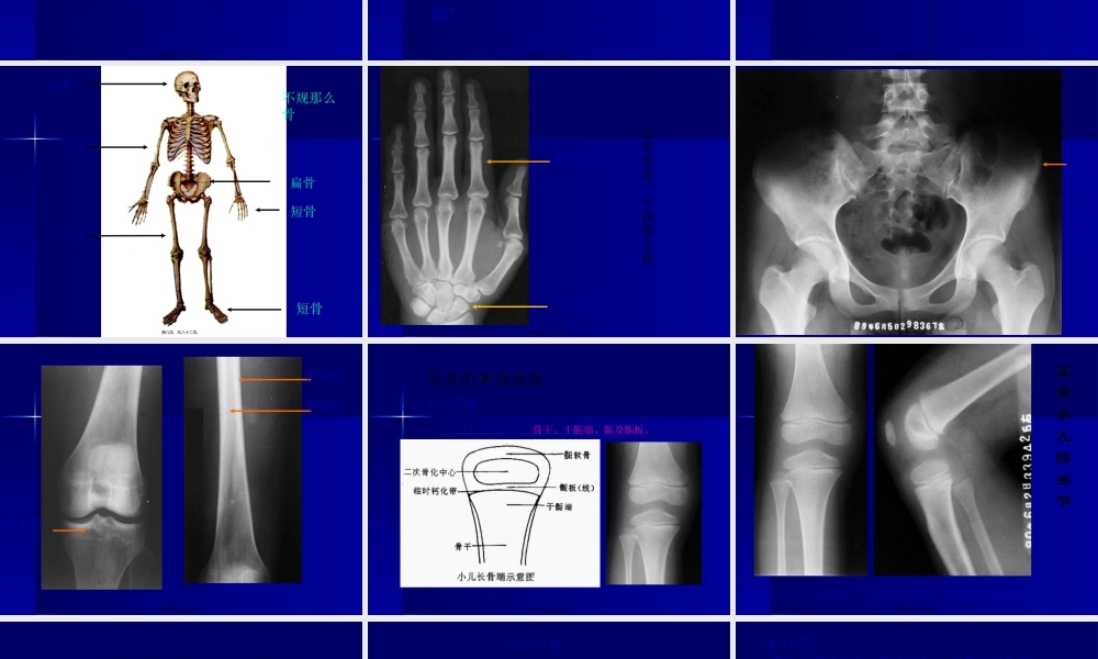 实习一--骨与关节正常表现.pptx