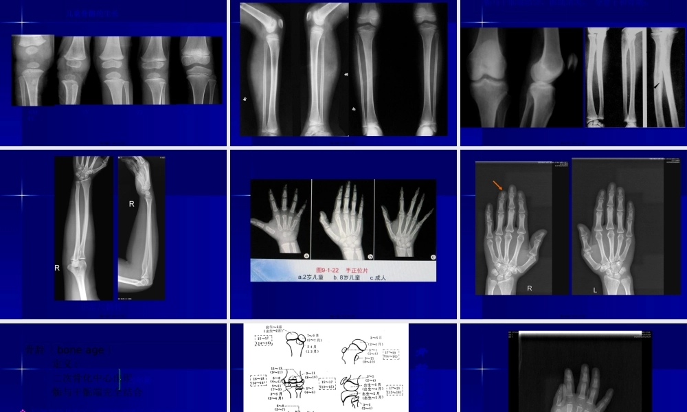 实习一--骨与关节正常表现.pptx