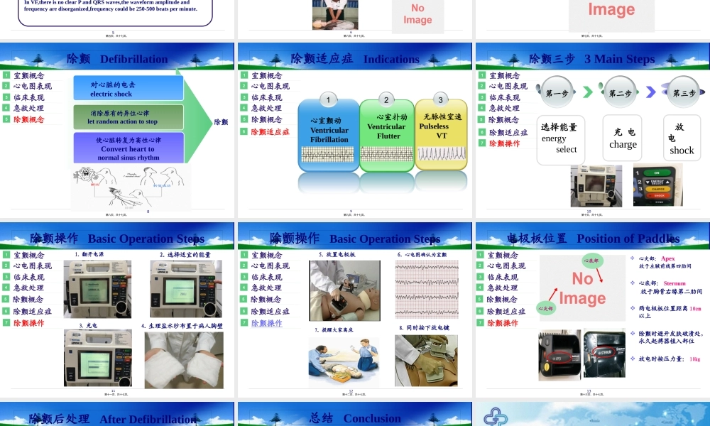 室颤与急救3.pptx