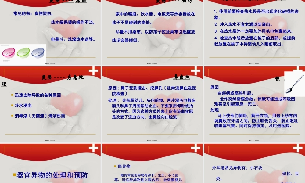 家庭意外伤害防范大全.pptx