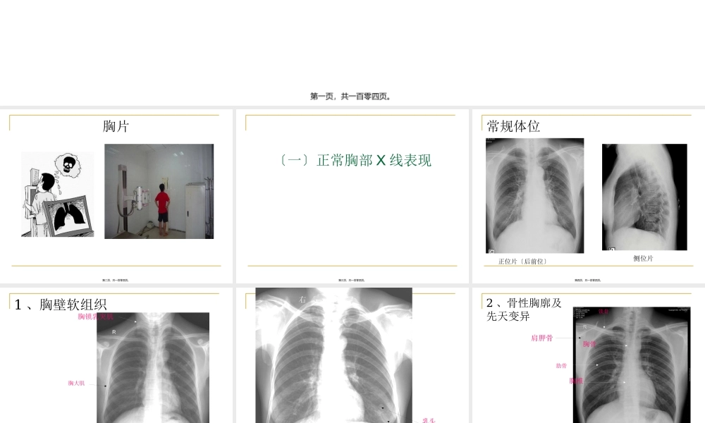 呼吸科X线、CT带教(正常、基本病变均包含).pptx
