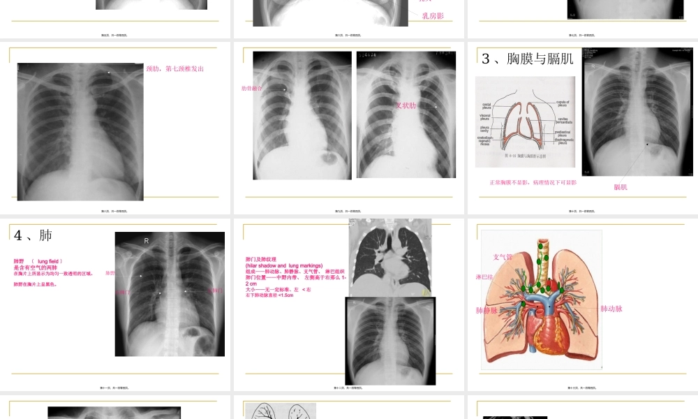 呼吸科X线、CT带教(正常、基本病变均包含).pptx