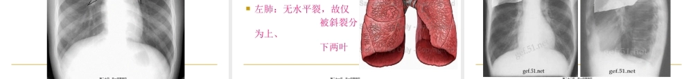 呼吸科X线、CT带教(正常、基本病变均包含).pptx