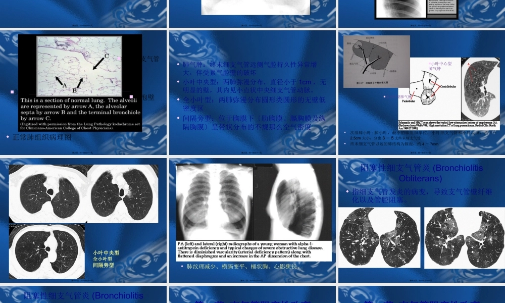 呼吸系统基本病变的影像学表现-(3).pptx