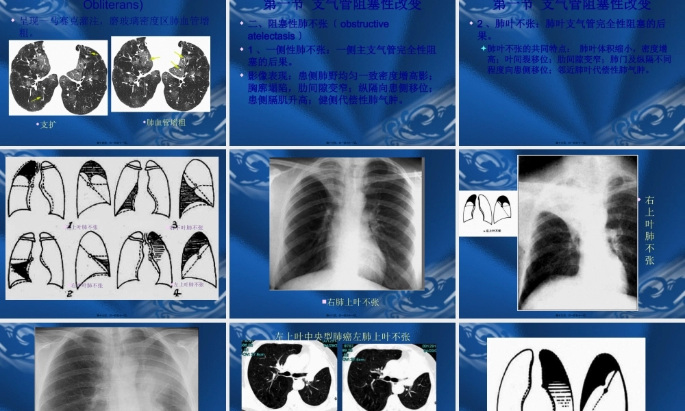 呼吸系统基本病变的影像学表现-(3).pptx