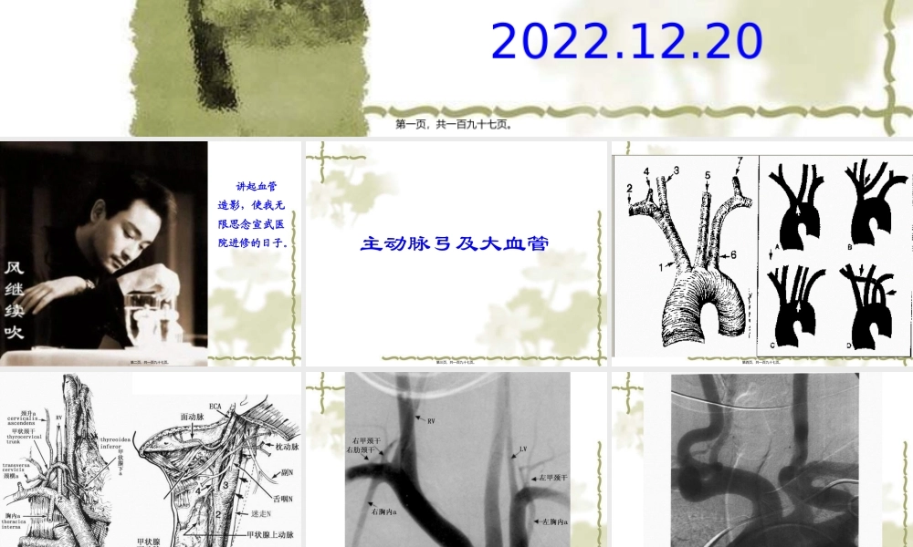 全脑血管造影.pptx