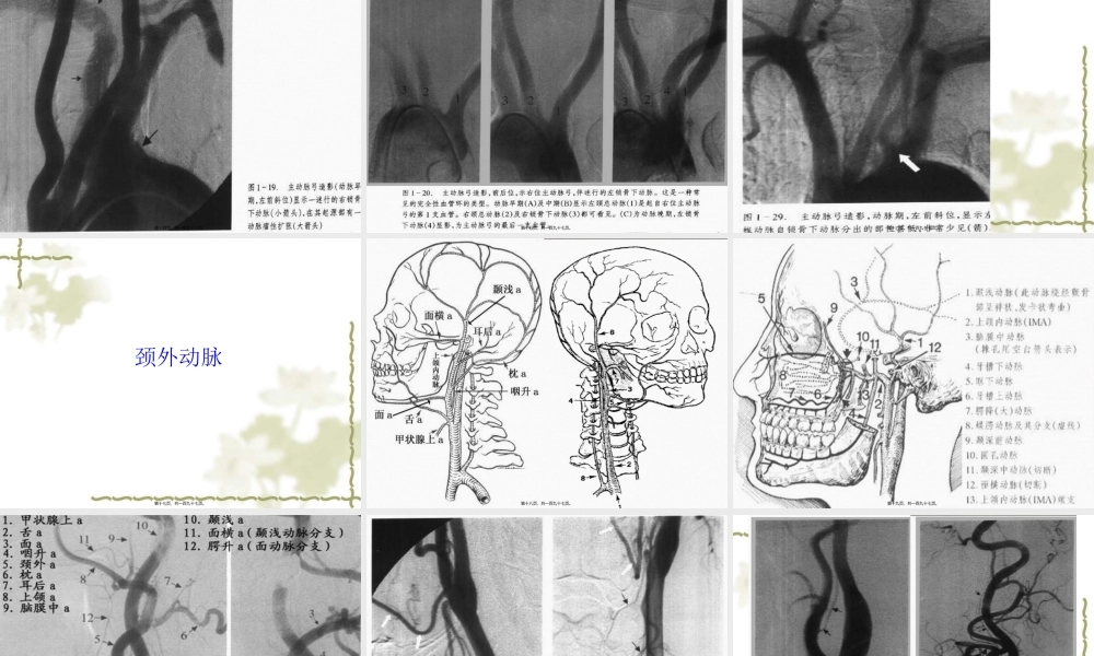 全脑血管造影.pptx