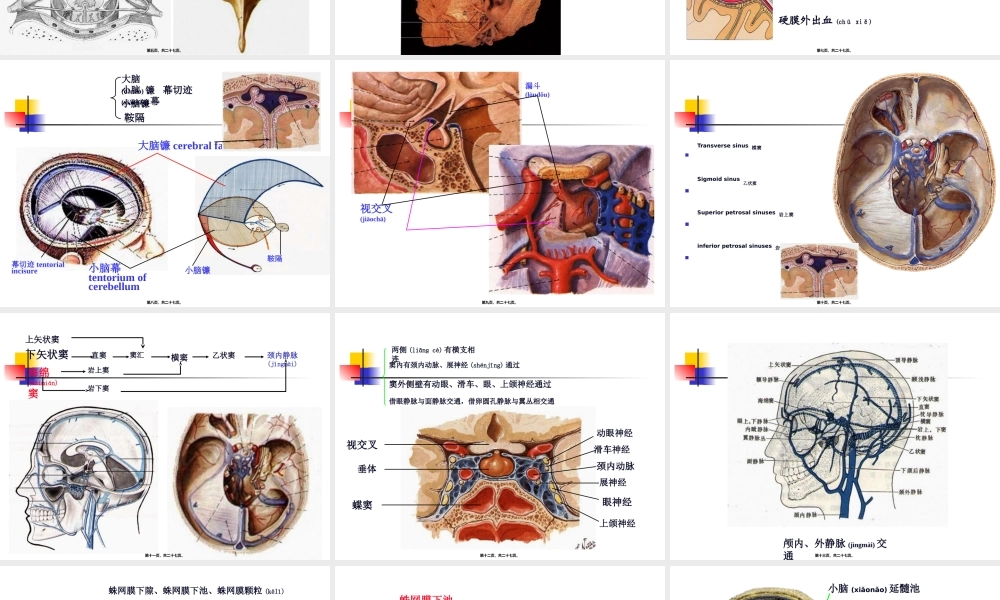 2022年医学专题—-脑和脊髓的被膜、血管及脑脊液(1).ppt