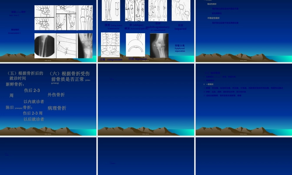 2022年医学专题—.1第六章-第一节骨折概论(1).ppt