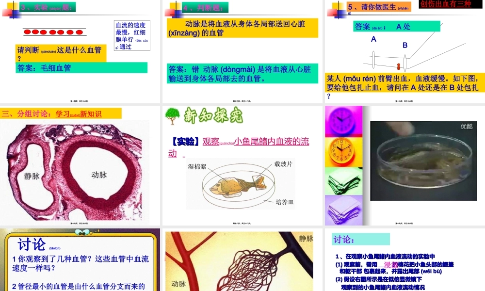 2022年医学专题—.4.2血流的管道——血管(1).ppt