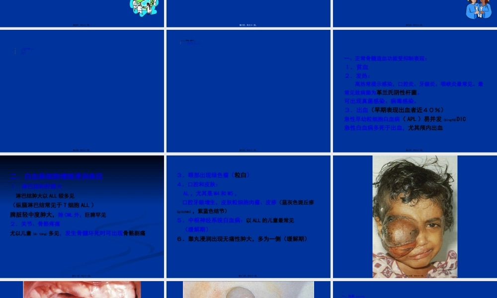 2023年医学专题—.急性白血病(1).ppt