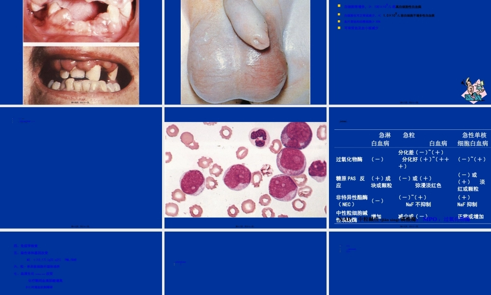 2023年医学专题—.急性白血病(1).ppt