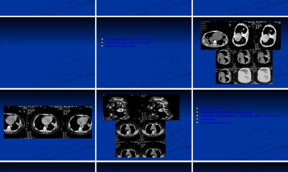 2022年医学专题—CT引导下肺穿刺活检术(1).ppt