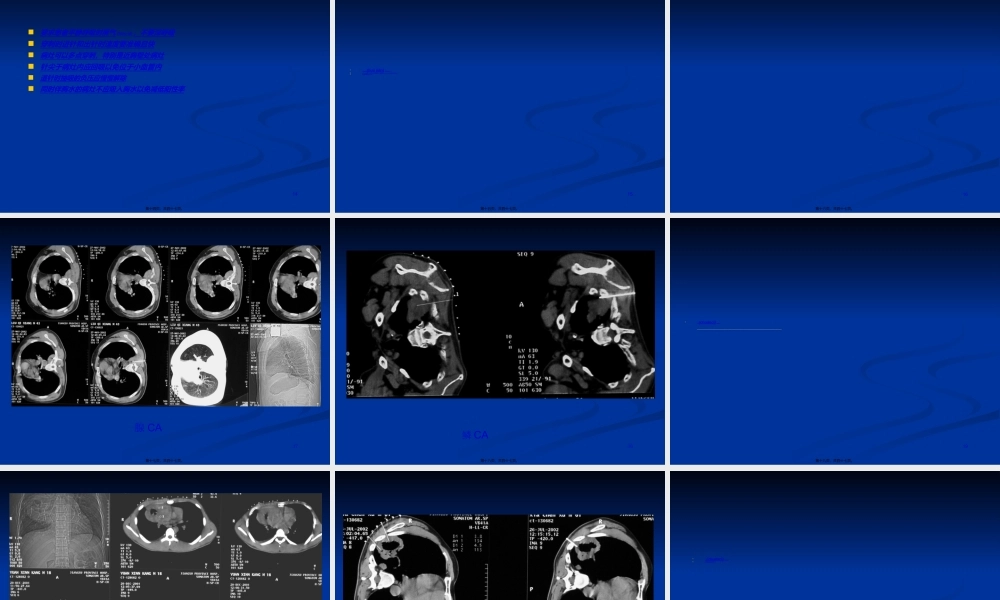 2022年医学专题—CT引导下肺穿刺活检术(1).ppt