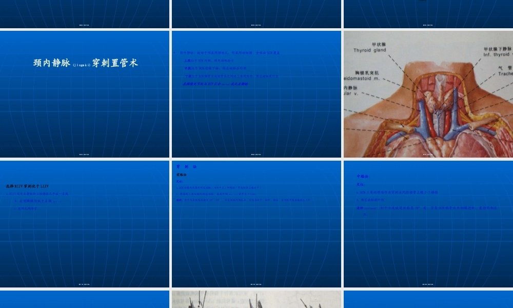 2022年医学专题—CRRT静脉穿刺置管术(1).ppt